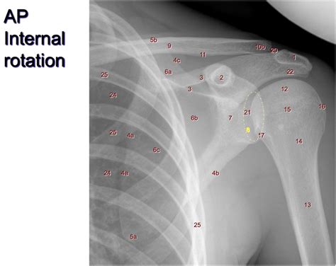 ap shoulder ir diagram quizlet