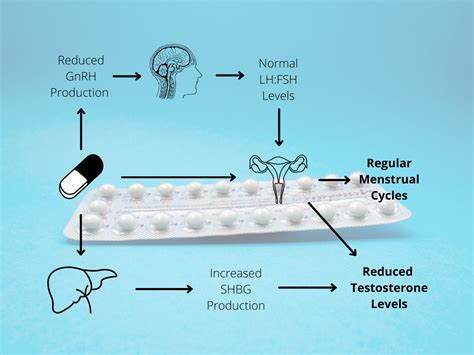 Treating Pcos With The Contraceptive Pill The Complete Guide — Pcos Centre