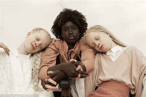 Albino Twins From São Paulo Become Models Black Beauties Albino Twins Black Is Beautiful