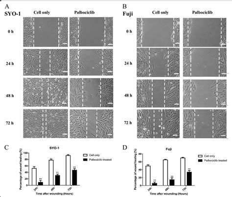 Inhibition Of The Cdk Rb Pathway By Palbociclib Reduced Human