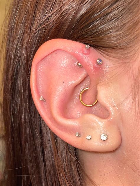 Piercing Bumps Vs Keloids What S The Difference And How To Treat Them