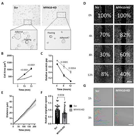 Ijms Free Full Text Myh10 Governs Adipocyte Function And