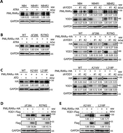 Blockade Of Deubiquitinase Yod Degrades Oncogenic Pml Rar And