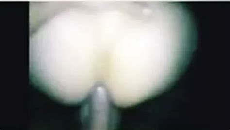 Vocal Anal Fuck Homemade Porn XHamster