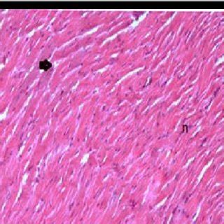 A Photomicrograph Of A Section In The Cardiac Muscle From The