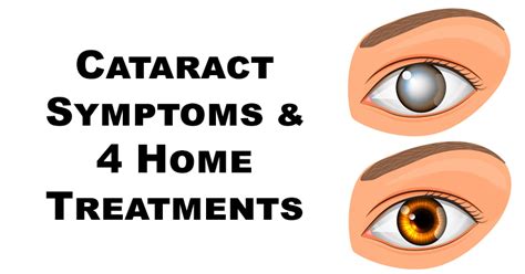 Cataract Symptoms & 4 Home Treatments - David Avocado Wolfe