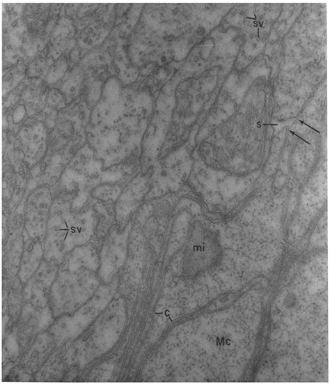 Electron Micrograph Of A Toad Retina At The Inner Plexlform Layer