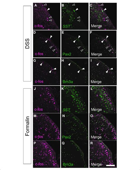 Immunostaining Of C Fos Together With Several Molecular Markers In The