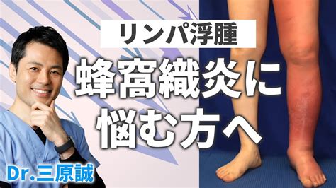 【リンパ浮腫患者さん向け】3分で解る！ 蜂窩織炎を抑える治療をご紹介 三原誠（リンパ浮腫専門医／むくみクリニック院長） Youtube