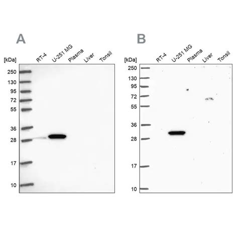 Anti RPL8 Antibody Produced In Rabbit