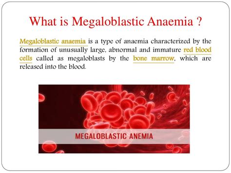 Megaloblastic Anaemia Symptoms Causes Diagnosis Treatment And Pre