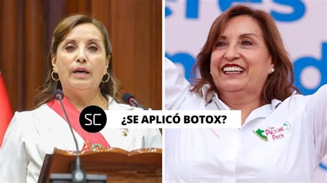 Dina Boluarte Tiene Un Antes Y Despu S Los Retoquitos De La