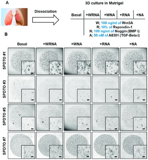 Establishment Of Tumor Organoids Derived From Small Cell Lung Cancer