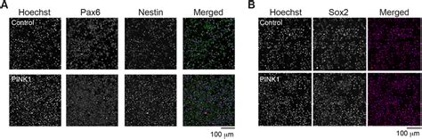 Analysis Of Neural Progenitor Markers In Pink1 Mutant Npcs A B Download Scientific Diagram