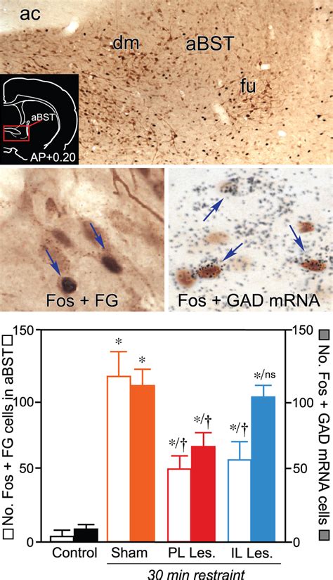 Top Brightfield Photomicrograph Showing Stress Induced Fos