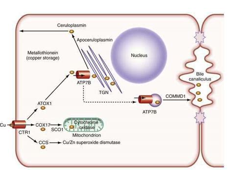 Wilson Disease Clinical Gate