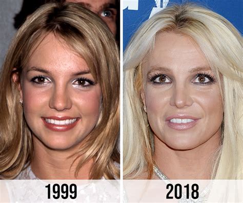 Britney Spears Fans Criticize Her Alleged Nose Job On Instagram