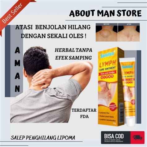 Jual About Man Obat Oles Penghilang Benjolan Lipoma Uci Uci Gondok