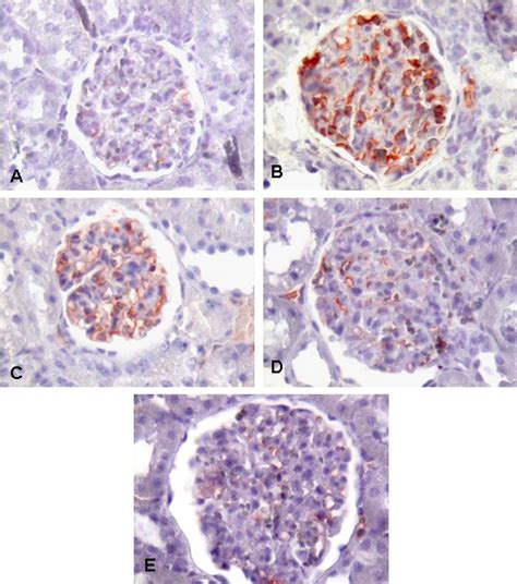 TGF-beta 1 immunoreactivity in the control group (A), untreated ...