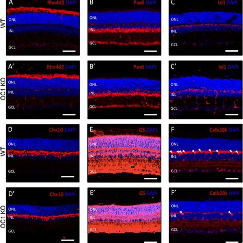 Assessment Of Horizontal Cells By Flat Mount Retina Staining To Better