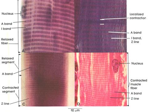 Skeletal Muscle Striations Labeled