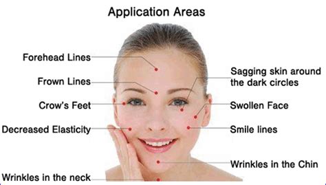 Cosmetic Acupuncture Facial Rejuvenation Lipman Clinic Health And