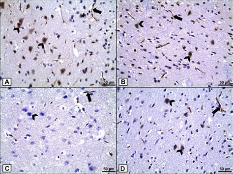 BCL 2 Immunohistochemical Staining A B Groups I And II Show A Strong