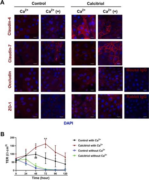 Calcitriol Modulates Epidermal Tight Junction Barrier Function In Human