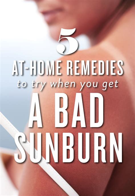 At Home Cures For Sunburns Cure For Sunburn Sunburn Relief Instant