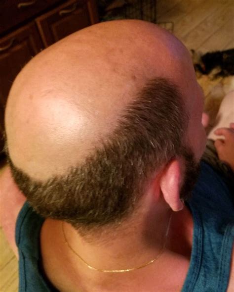 Pinterest Bald Men Style Male Pattern Baldness Bald Men