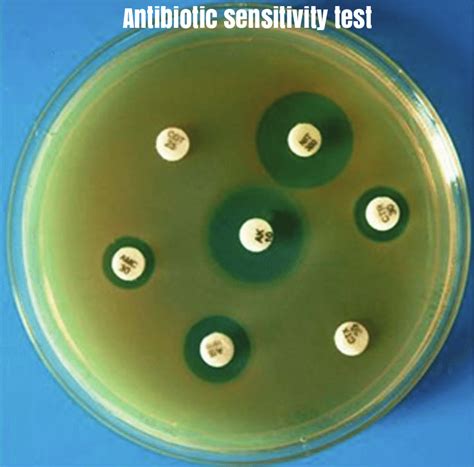 Antibiotic Sensitivity Test And Result Medical Microbiology