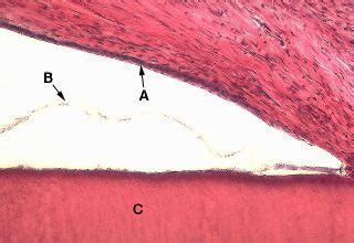 Oral Histology Digital Lab Development High Power Of Reduced Enamel