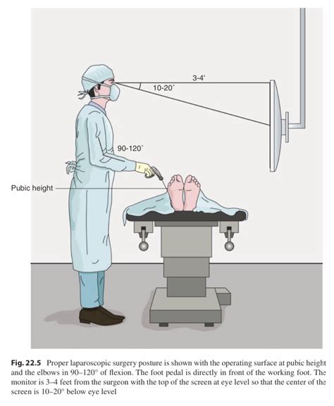 Cirbosque SoMe4Surgery On Twitter The Ideal Surgeons Posture During