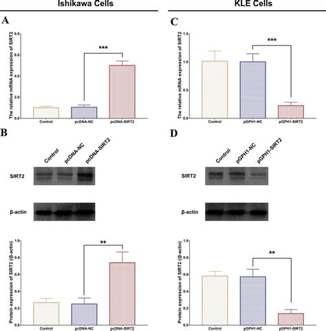 SIRT2 Expression In EC Cells After Transfection The Effect Of SIRT2