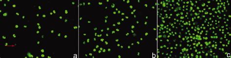 Calcein AM PI Live Dead Staining Of 3T3 Fibroblasts In CCS A CS B