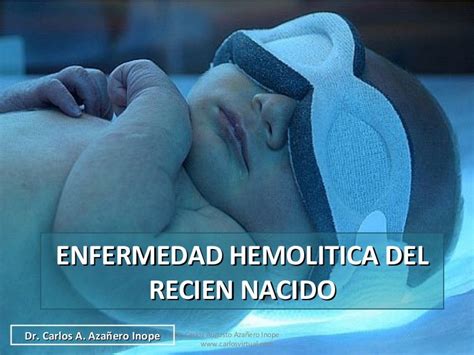 Enfermedad Hemolitica Del Recien Nacido