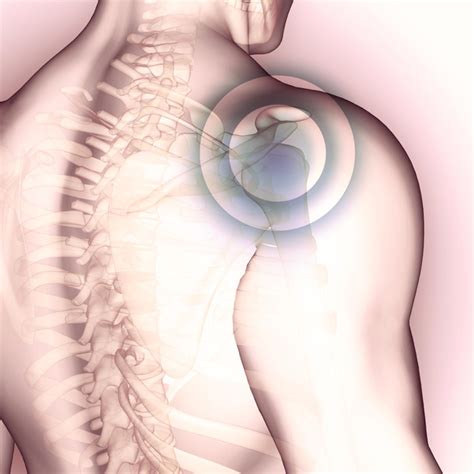 Stem Cell Therapy For Shoulder Pain Stemaid Institute