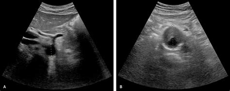 Point Of Care Ultrasonography Aafp