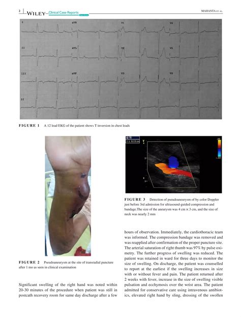 Radial Artery Pseudoaneurysm Pdf