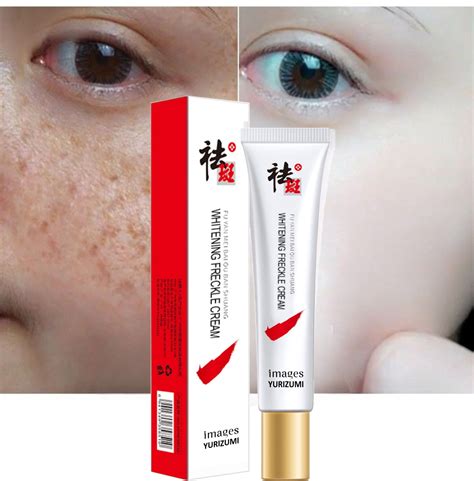 Cream Bintik Melasma Krim Penghilang Flek Hitam Whitening And Freckle Removing 20g Lazada