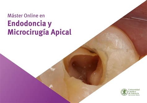 PDF Máster Online en Endodoncia y Microcirugía Apical Este Máster