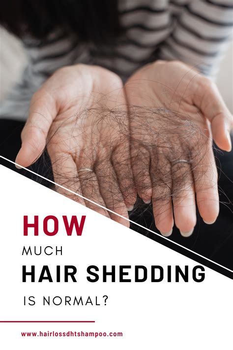 How Much Hair Shedding Is Normal? | Hair shedding remedies, Normal hair fall, Excessive hair fall