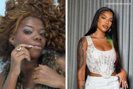 Ludmilla Antes E Depois Da Cantora Ap S Cirurgias