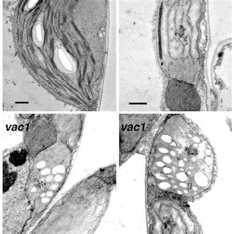 Transmission Electron Micrographs Of Wild Type Wt And Vac Mutant