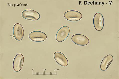 Myco Microscopie Ascospores De Peziza Varia M Lecomte J Pellicani