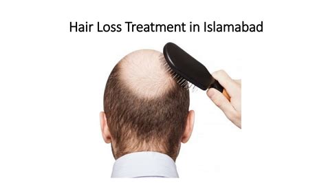 PPT Hair Loss Treatment In Islamabad PowerPoint Presentation Free