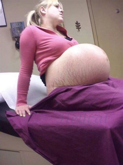 Gorgeous Stretch Marks Porn Pic