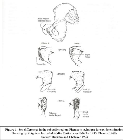 Figure 1 From Sex Estimation In Forensic Anthropology Using The Radius