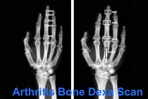 Bone Dexa Scan Rajmit Health Care Services