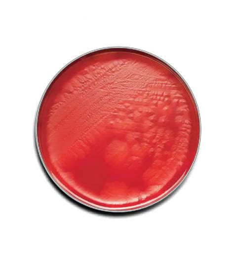 Buy Bd Bbl Prepared Plated Media Cdc Anaerobe Sheep Blood Agar